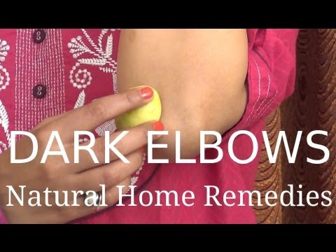 Dark Elbows - Natural Home Remedies