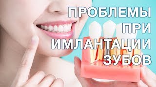 Какие противопоказания к имплантации зубов?