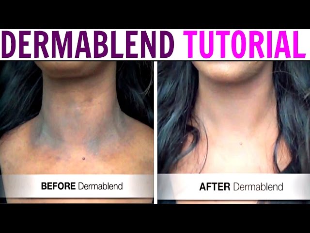 Cover Scars, Tattoos, Dark Spots with DERMABLEND - Best Body Makeup Ever! 