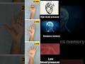 Daily Mudras #high #blood #pressure #sharpens #memory #lowbloodpressure #shortsfeed #viralvideo