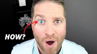 Heterochromia: DifferentColored Eyes  How Does This Happen?