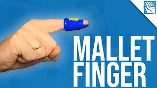 Can't Lift Your Fingertip ? - Mallet Finger Recovery - Part 2