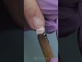 Dangerous Hangnail ⚠️ DON’T bite it off!