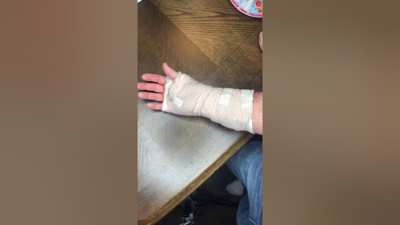 Carpal Tunnel Surgery Bandage Removal YouTube