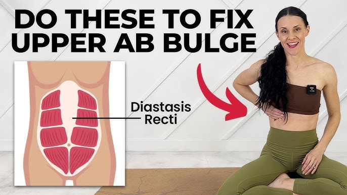 Heal Diastasis Recti FAST – Physiotherapy Guide to FIX & FLATTEN