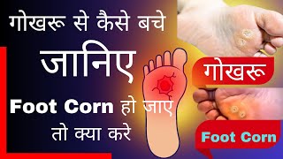 पैर का गोखरू कैसे ठीक करें / FOOT CORN REMOVAL AT HOME / गोखरू / Foot Corn