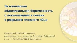 Эктопическая абдоминальная беременность с локализацией в печени с разрывом плодного яйца