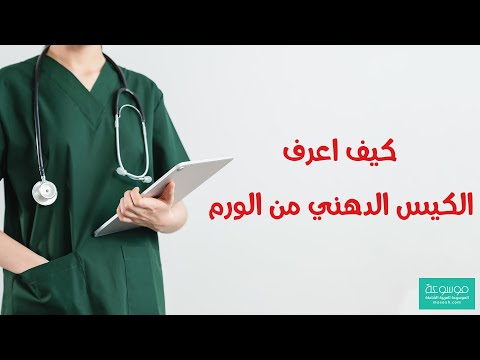 فيديو: هل الكيس المخاطي هو كيس عقدي؟