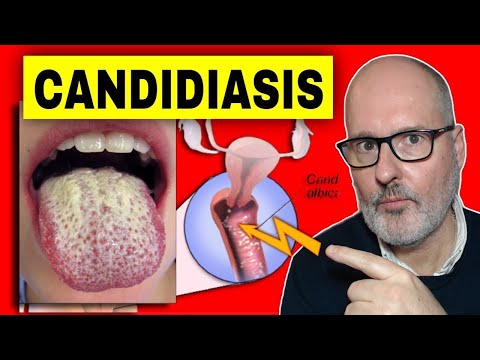 Vídeo: On es troba Candida albicans?