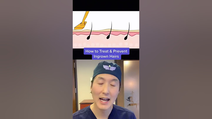 How to Prevent & Treat Ingrown Hairs! #shorts #ingrownhair