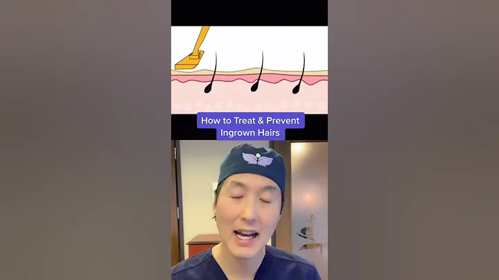 How do you stop getting ingrown hairs even when you exfoliate? (2023)