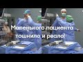 Маленького пациента  тошнило и рвало! Арахноидальная киста