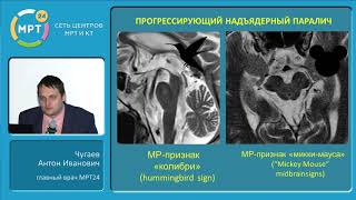 МР-диагностика нейродегенеративных заболеваний