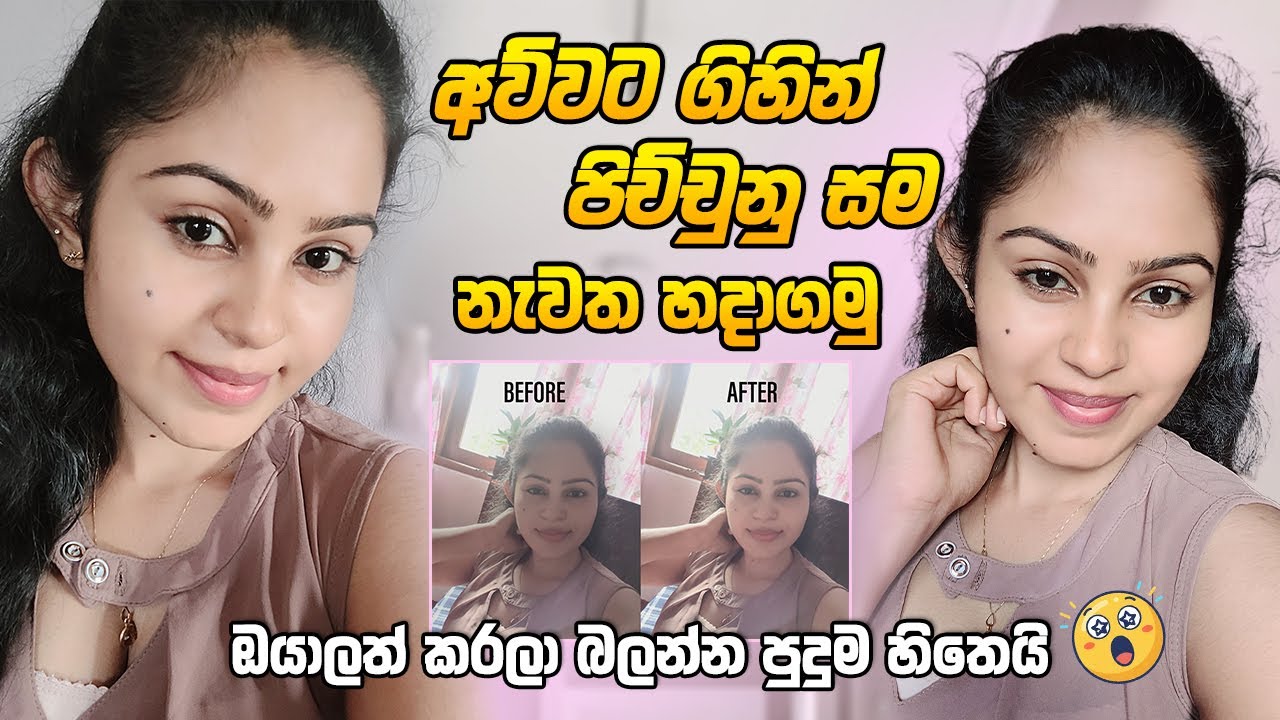 අව්වට පිච්චුන සම නැවත හදාගමු  - skincare routine #skincare #dayvlog