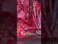 Pelvic Lymph Node Dissection | Short Video Education | Ep 03