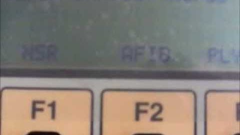 Defibrillator Part VII: Synchronizer/Cardioversion