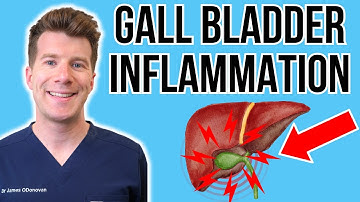 Doctor explains Acute Cholecystitis (Gall bladder inflammation) | Causes, symptoms, treatment & more