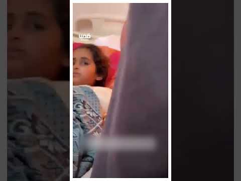 بكاء طبيب كويتي عند رؤيته طفلة غز ية مبتورة اليد