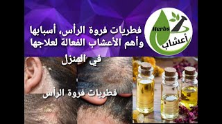 علاج فطريات فروة الرأس و القشرة بالأعشاب و الزيوت الطبيعية . #قناة_اعشاب #أعشاب #قشرة_الراس