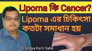 Cure LIPOMA | Lipoma treatment in homeopathy | common among all | lipoma treatment at home | Bengali screenshot 5