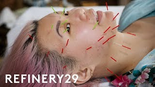 I Tried This Intense Acupuncture Facial | Beauty With Mi | Refinery29
