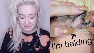 Answering Your Questions About My Stalker