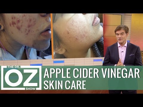 Video Facial Cleansers To Get Rid Of Acne