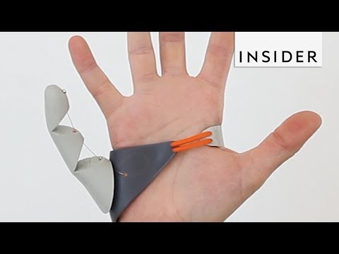 Video: One Hand With Six Fingers Has Replaced Two With Five - Alternative View