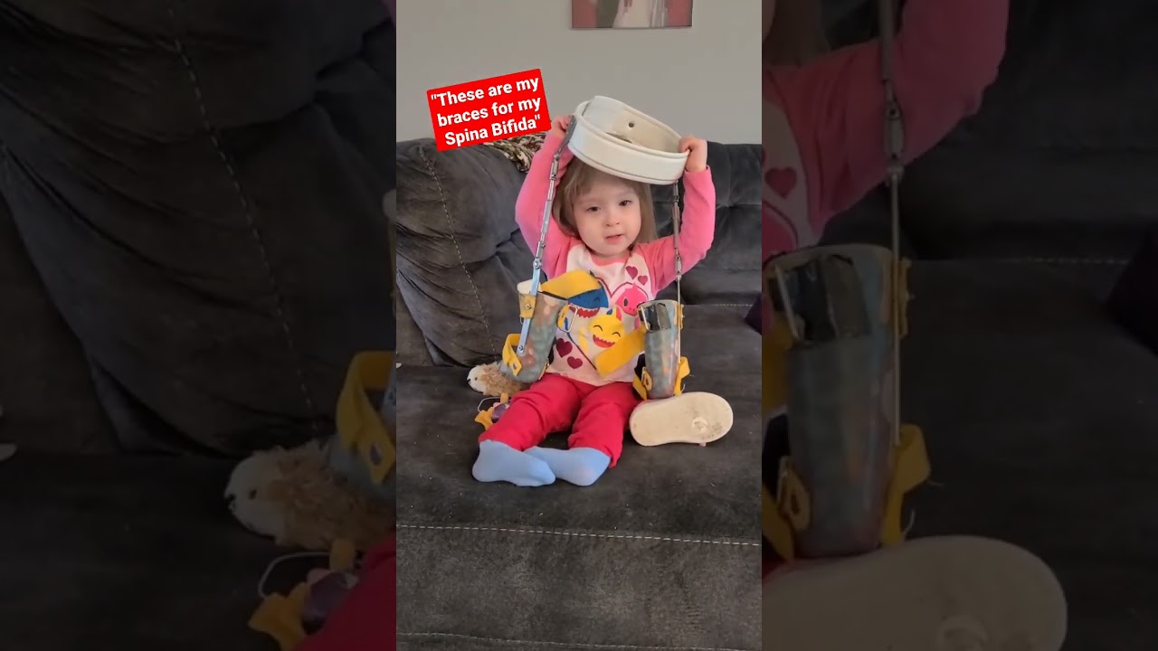 Lacey showing off her leg braces! 