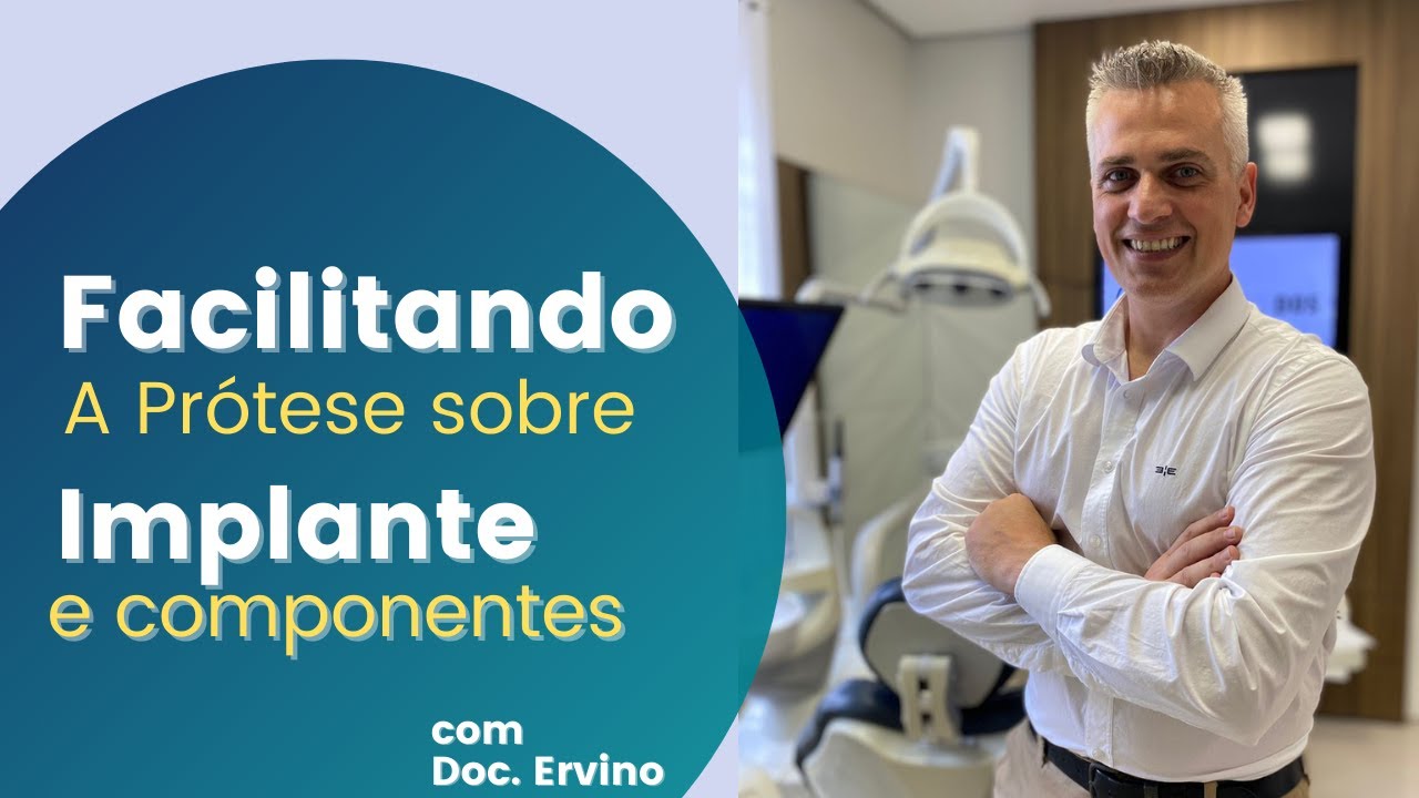 Seleção de componentes protéticos para implantes