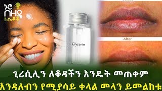 Ethiopia:- ጊሪሲሊን ለቆዳችን እንዴት መጠቀም እንዳለብን የሚያሳይ ቀላል መላን ይመልከቱ screenshot 1