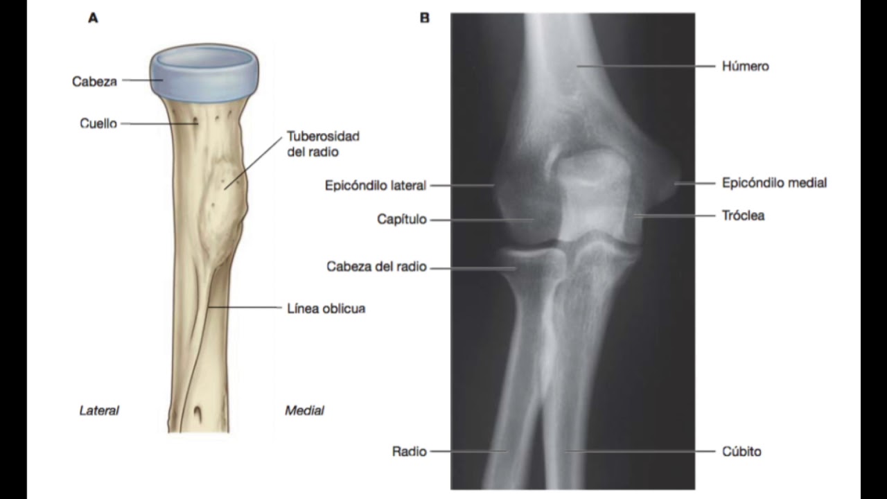Húmero, Radio y Cúbito - YouTube