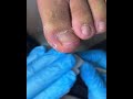 Satisfying Toenail Grooming | Gentle Foot Care Routine  #fypシ #cleannails #RelaxingCare #fypシ