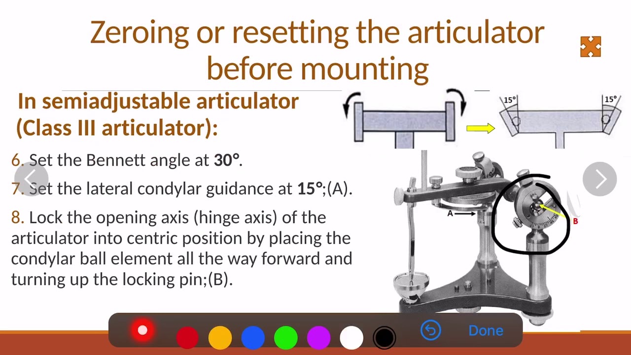 2-10 Prosthodontics, Mounting.