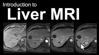 Introduction to Liver MRI: Approach and Case-Based Course