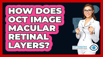 How Does OCT Image Macular Retinal Layers?