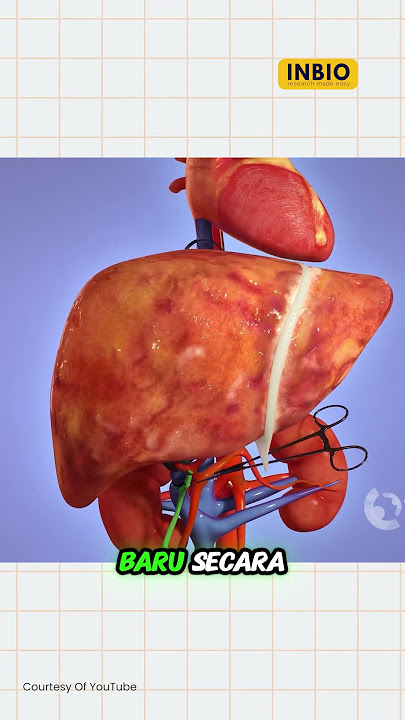 Apa boleh donor setengah hati?