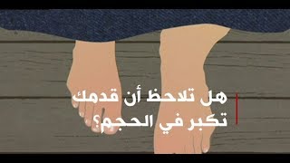 هل تلاحظ أن قدمك تكبر في الحجم؟