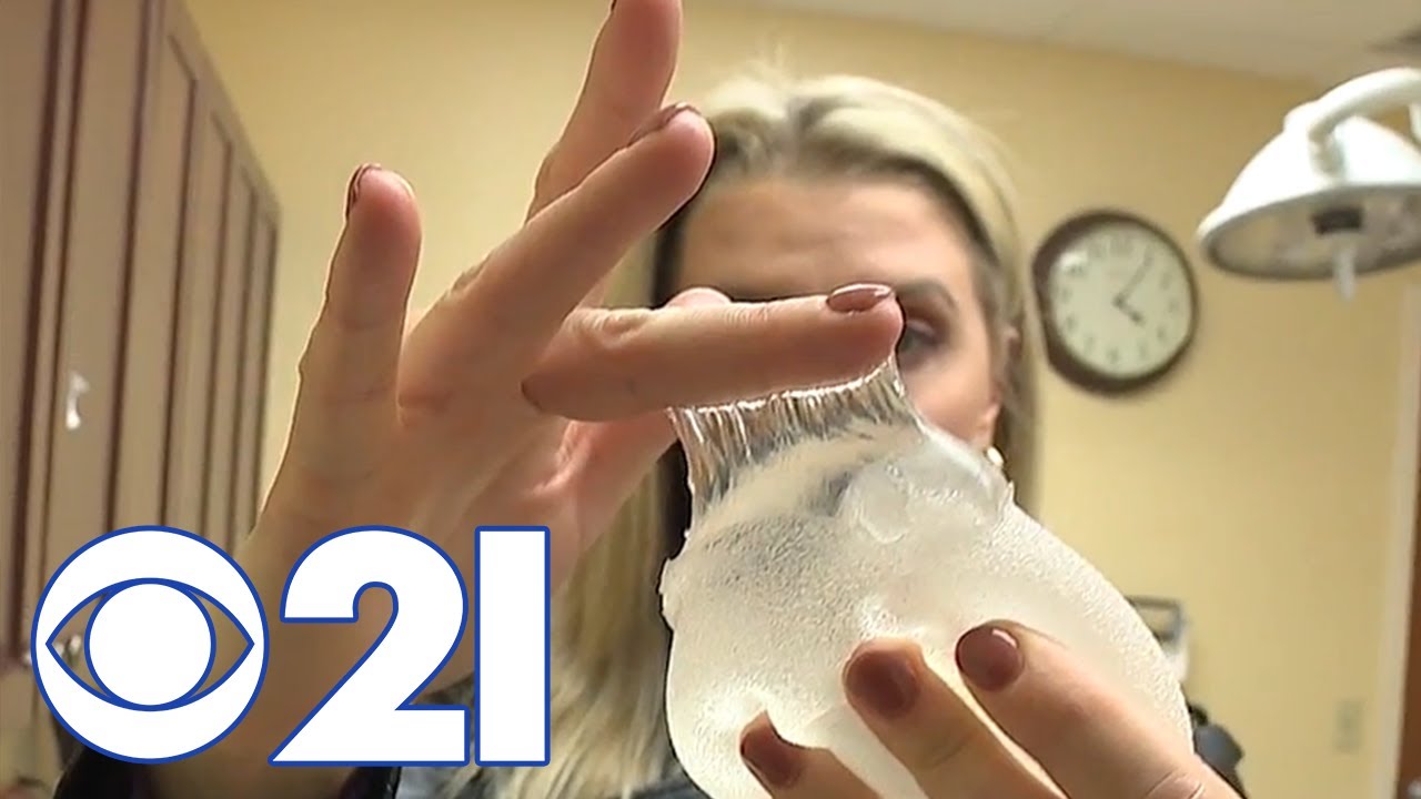What is Breast Implant Illness? CBS 21's Jasmine Brooks shares her story - Health Reporter