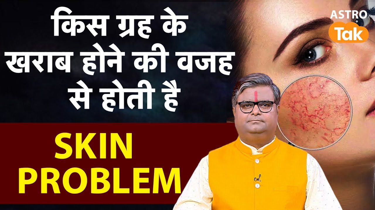 Skin Problem Remedies: किस ग्रह के खराब होने की वजह से होती है SKIN PROBLEM ?
