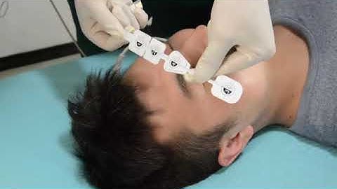 Bispectral Index Sensor