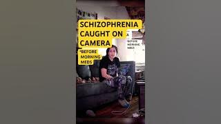 Schizophrenia Real Patients Video 29 #mentalhealth #schizophrenia #shorts