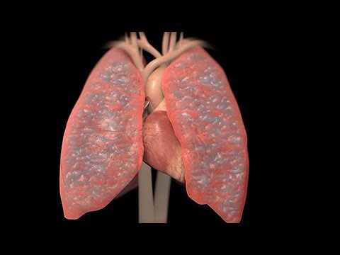 Video: ¿Por qué la insuficiencia cardíaca congestiva provoca edema?