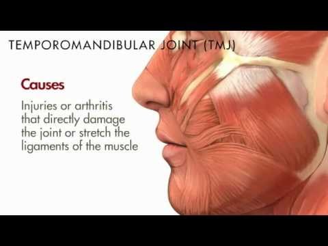 TMJ- Temporomandibular Joint - YouTube