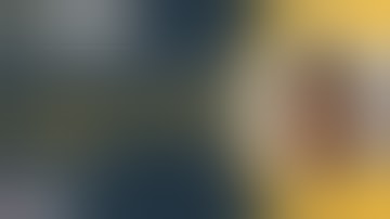 Deltoid Split Approach for Proximal Humerus Fracture - Dr. Dipit Sahu