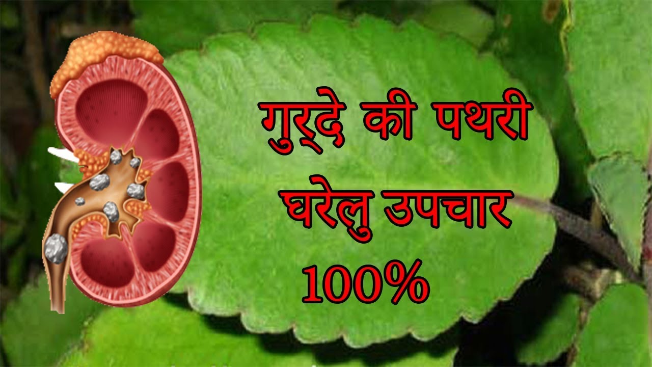 गुर्दे की पथरी का घरेलू उपचार - YouTube