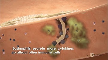 Human infection and immune response to Anisakis