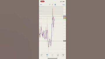 FULL MARGIN GOLD 20usd-70usd in 1hour🤣🤣🗿🗿