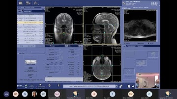 Live Scanning Demo of Body Imaging Using AIR™ Coils on the SIGNA™ Artist