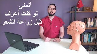 أتمنى لو كنت أعرف قبل عملية زراعة الشعر